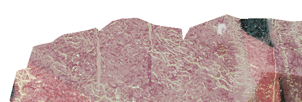 texture-4-1
